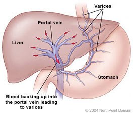 Hepatic Disease in Dogs Flashcards Quizlet